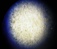 フロックを顕微鏡で見ると多数の微生物が存在している。